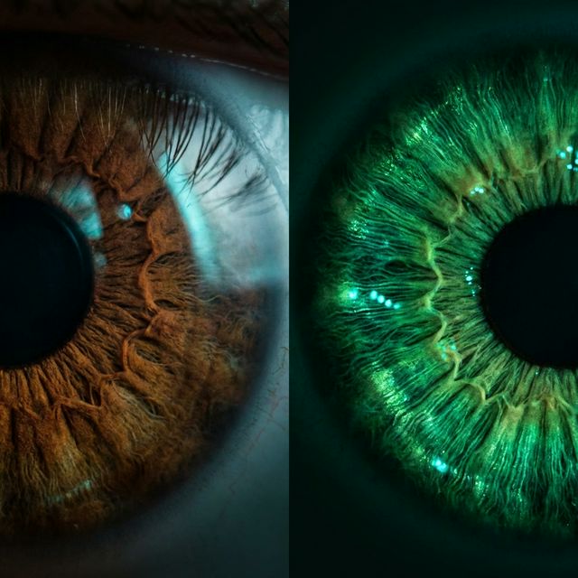 Eye color change before and after